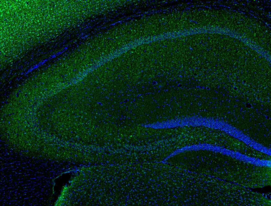 IL-1a Antibody
