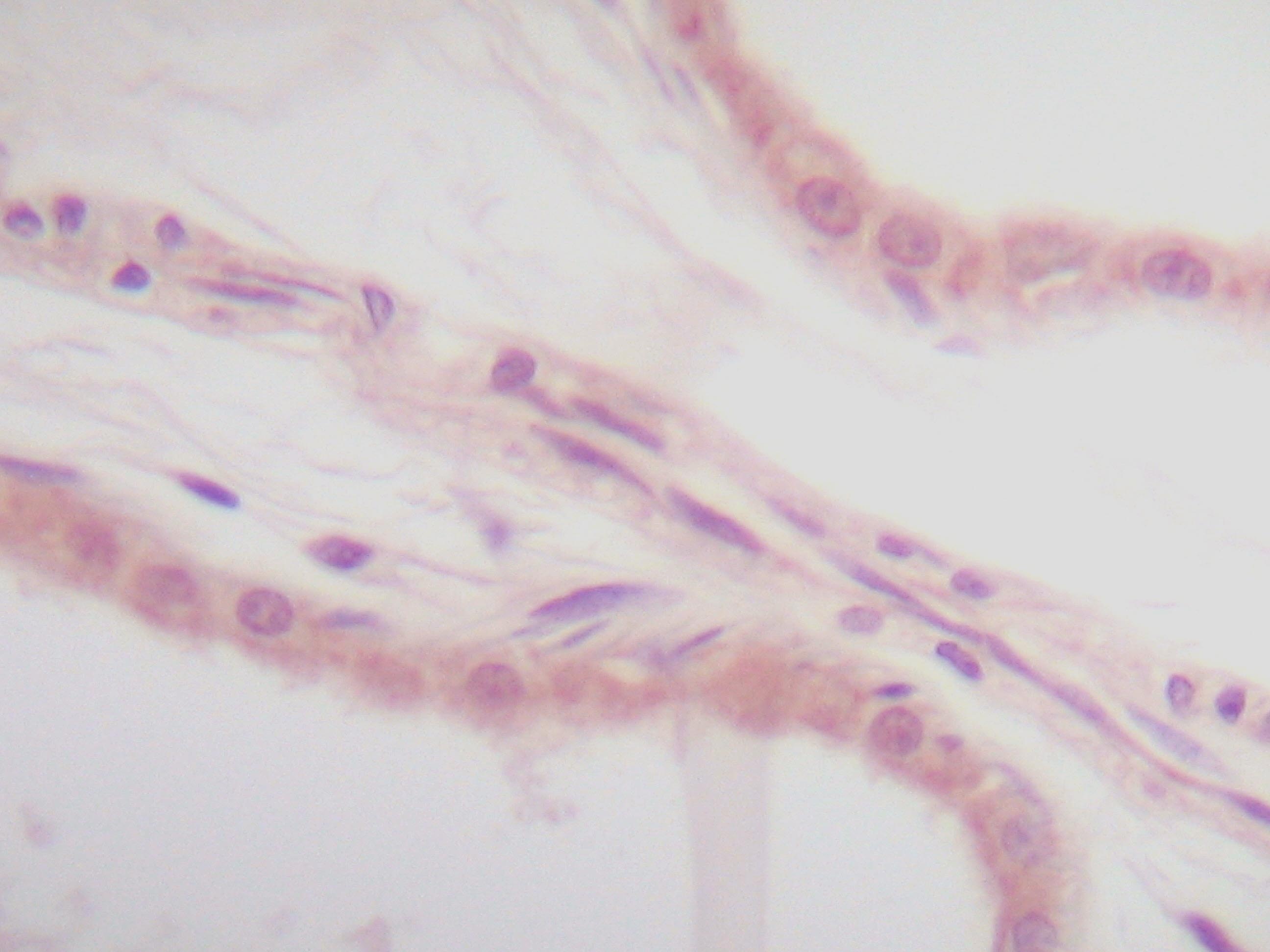 IL-1a Antibody