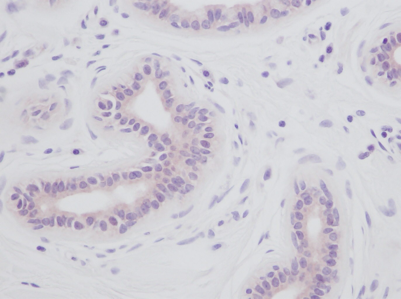 IL-1a Antibody