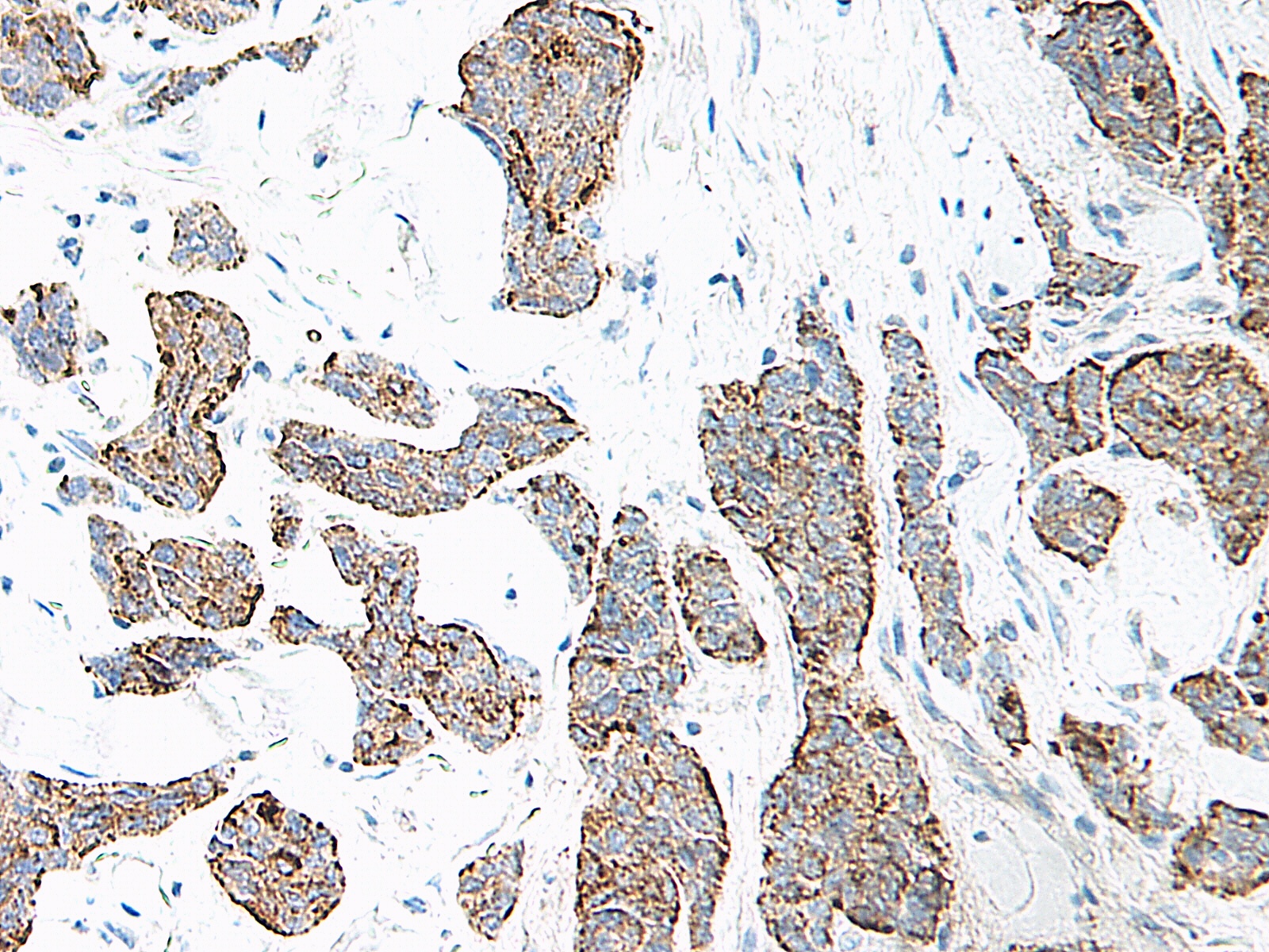 IL-17 Antibody