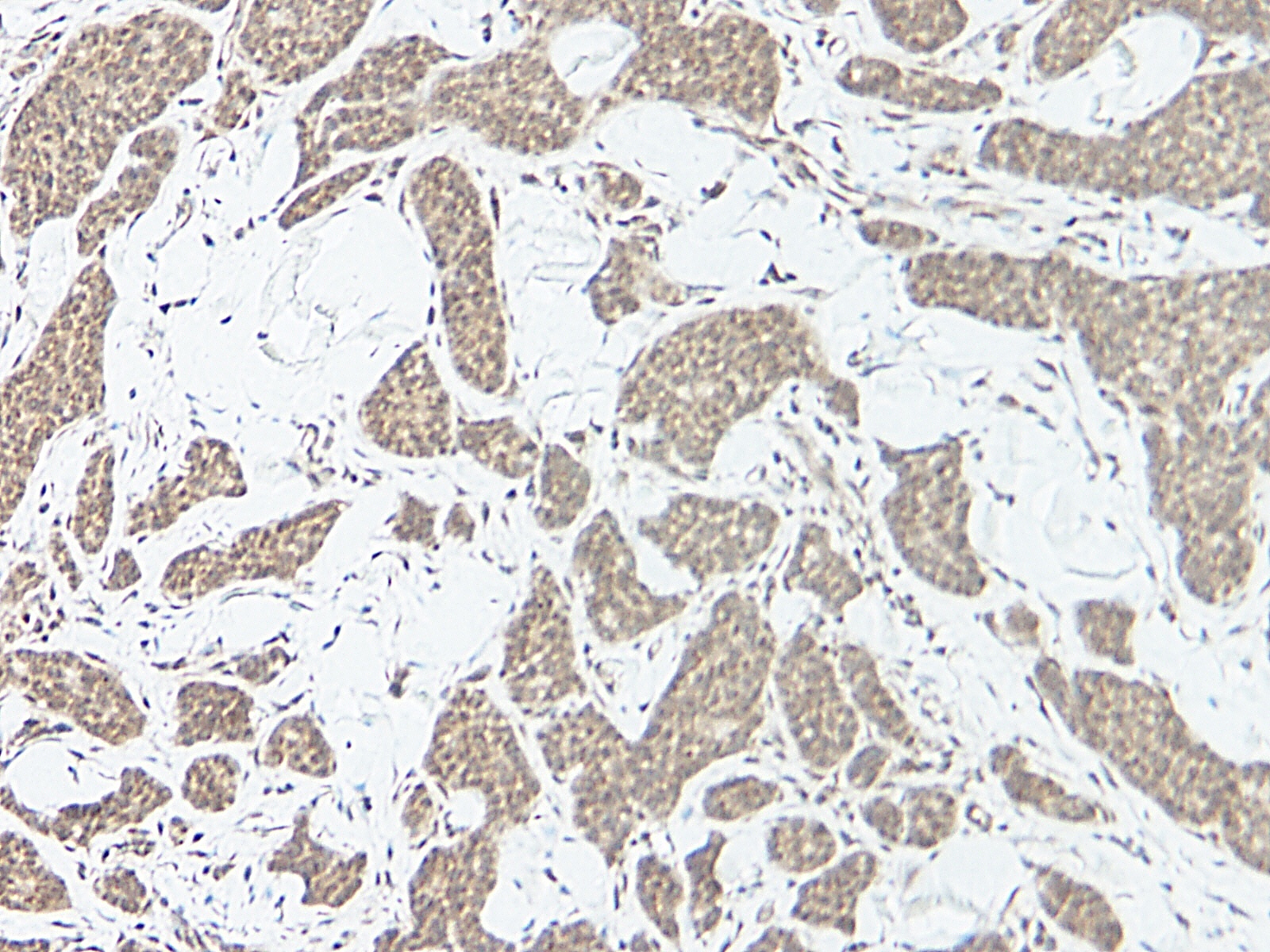 IL17A Antibody