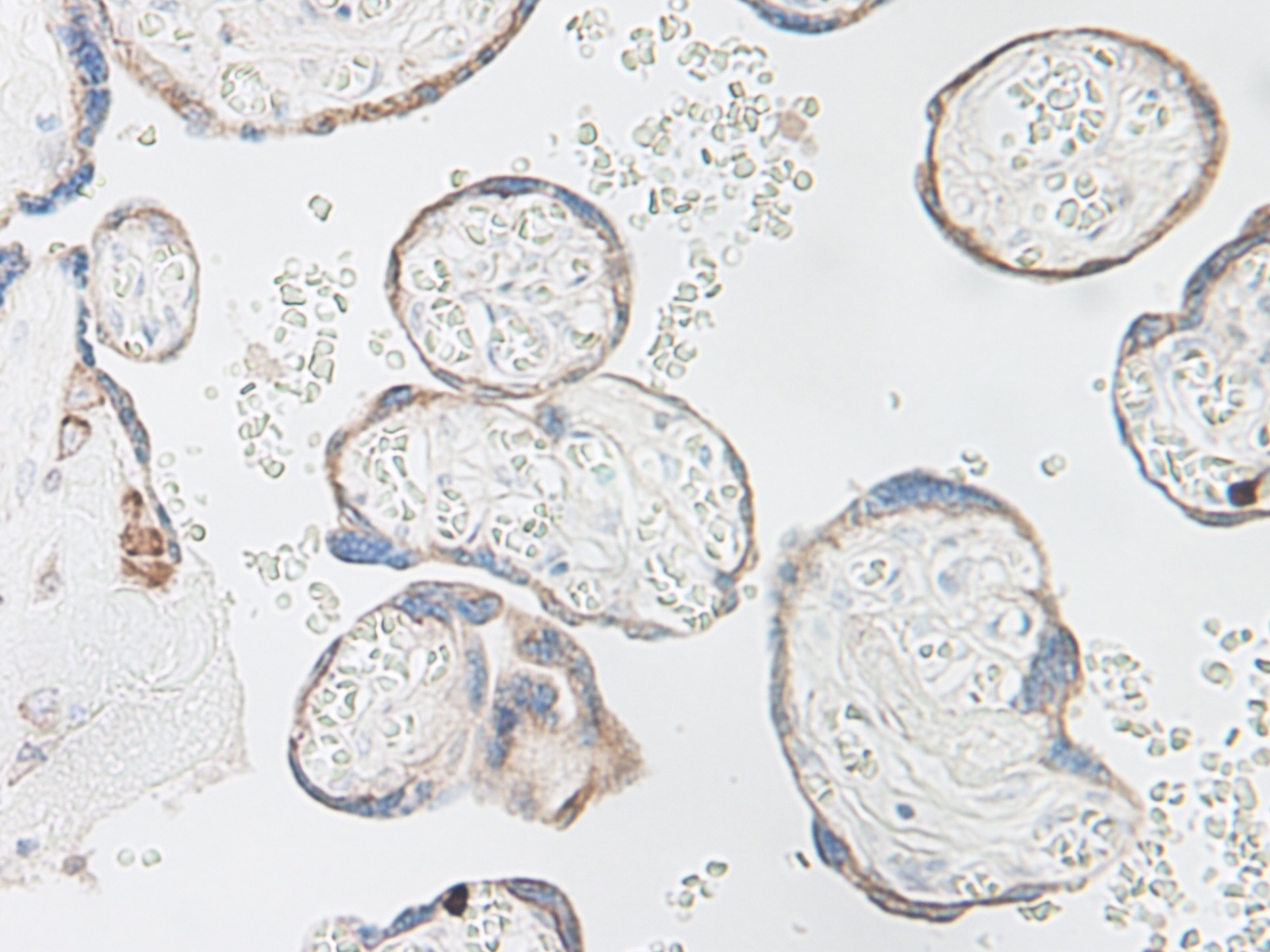 IL-15 Antibody