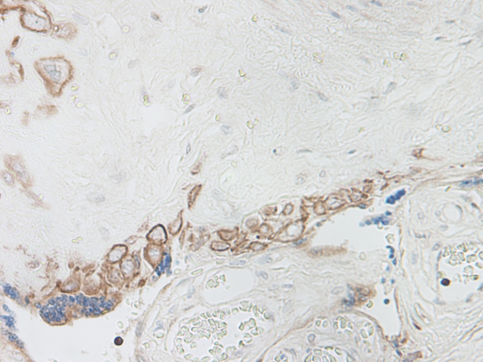 IL-15 Antibody