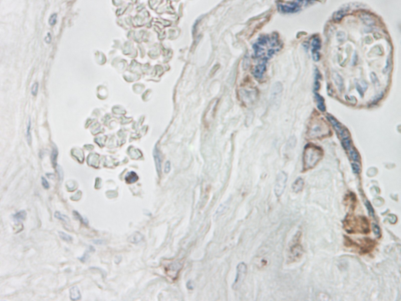 IL-15 Antibody