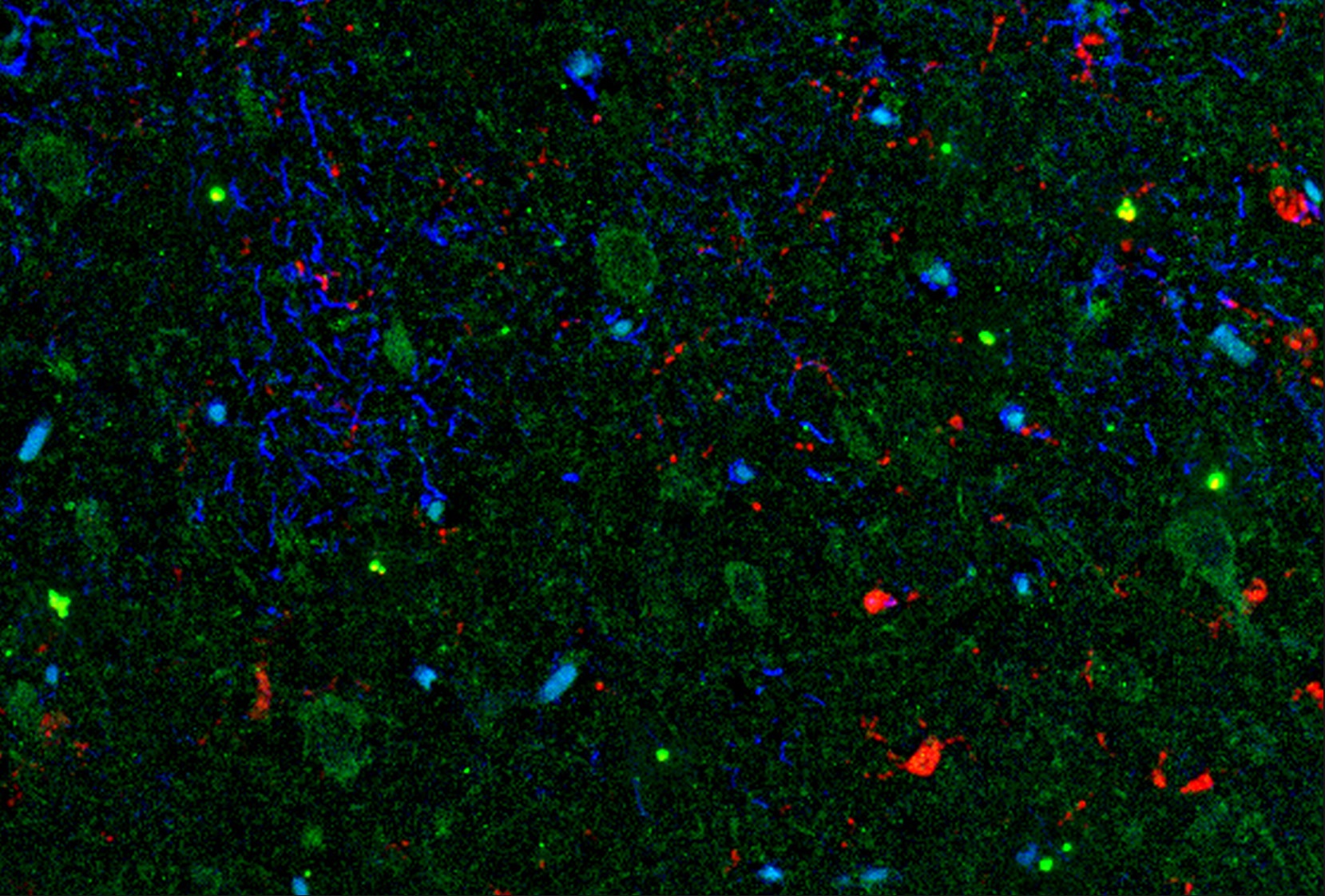 IL11 Antibody