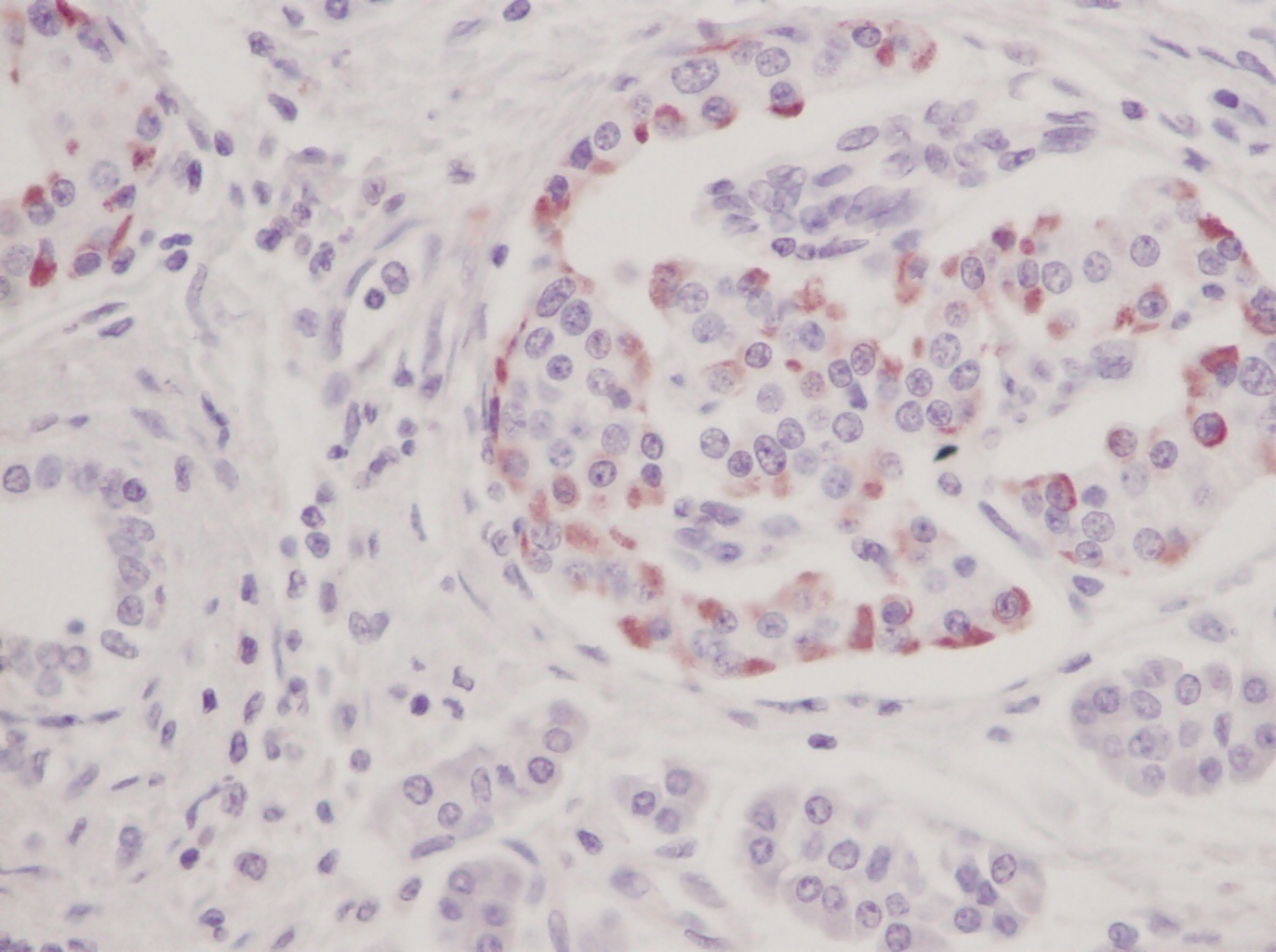 IL-10 Antibody
