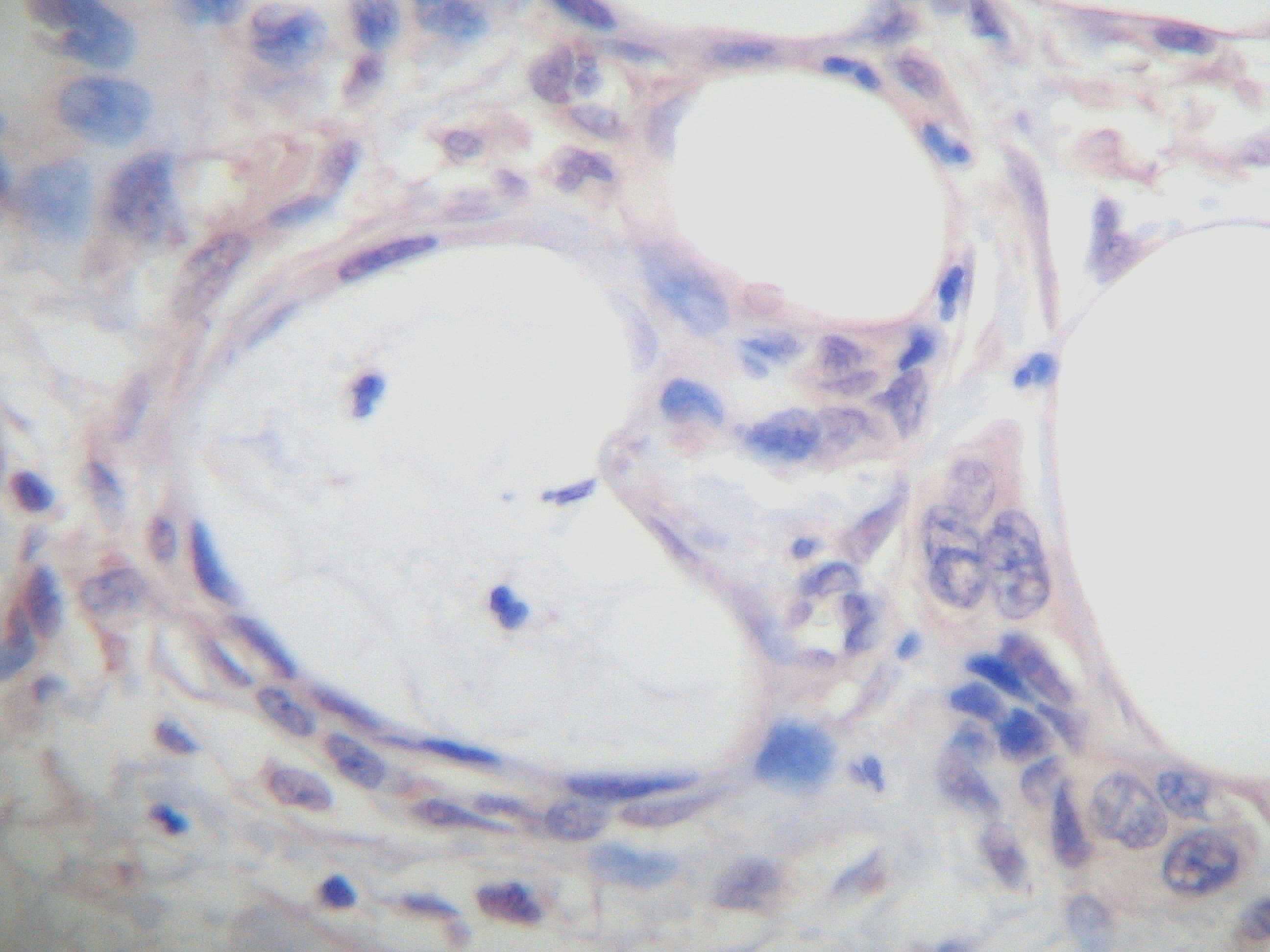 IL-10 Antibody