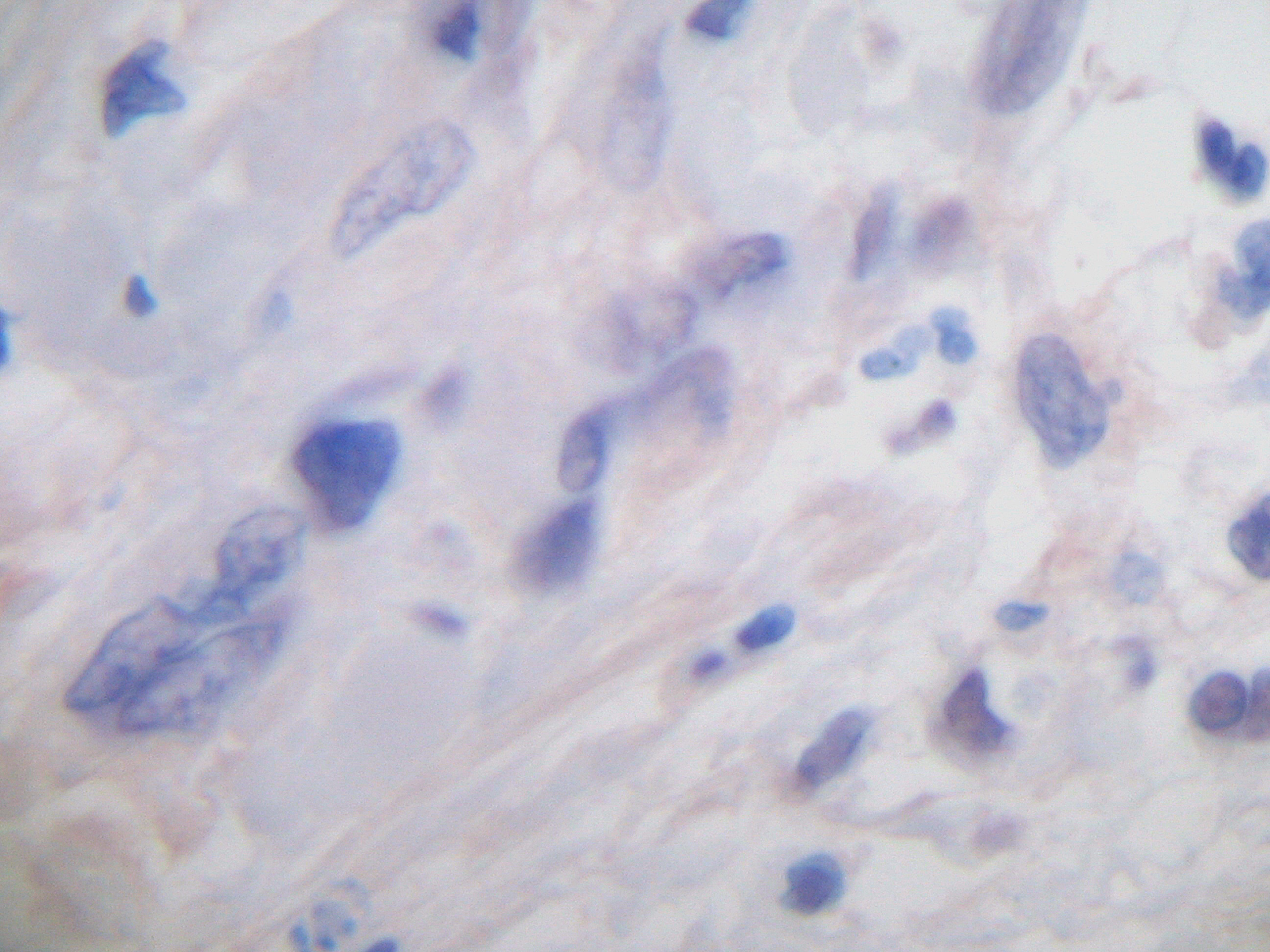 IL-10 Antibody