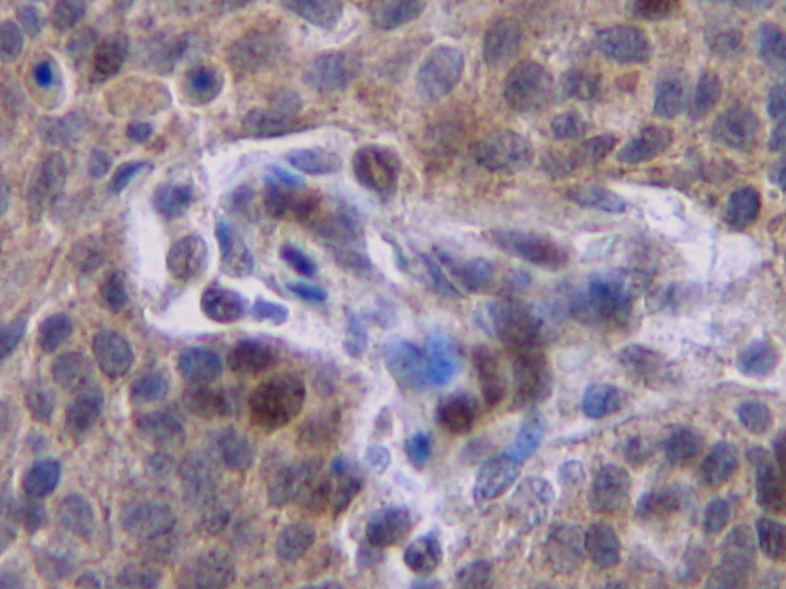 IFNG Antibody