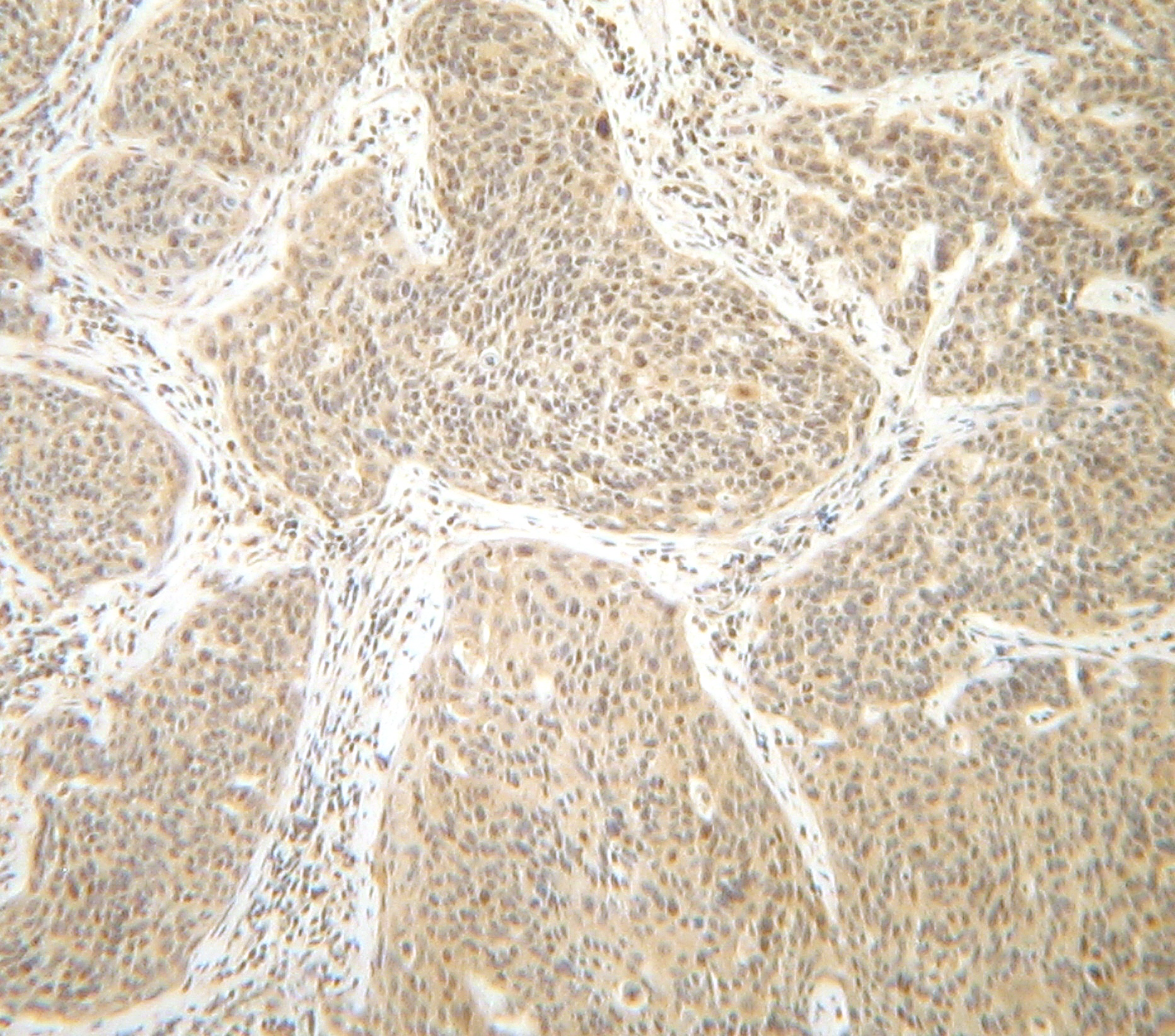 IFNG Antibody