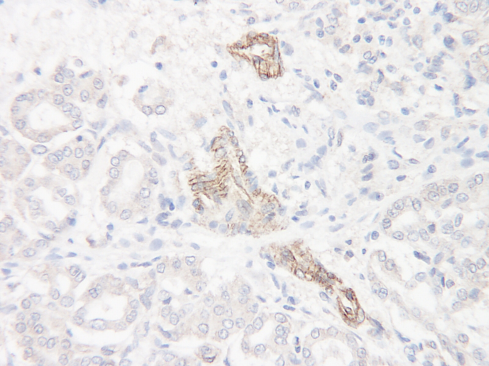 I-309 Antibody