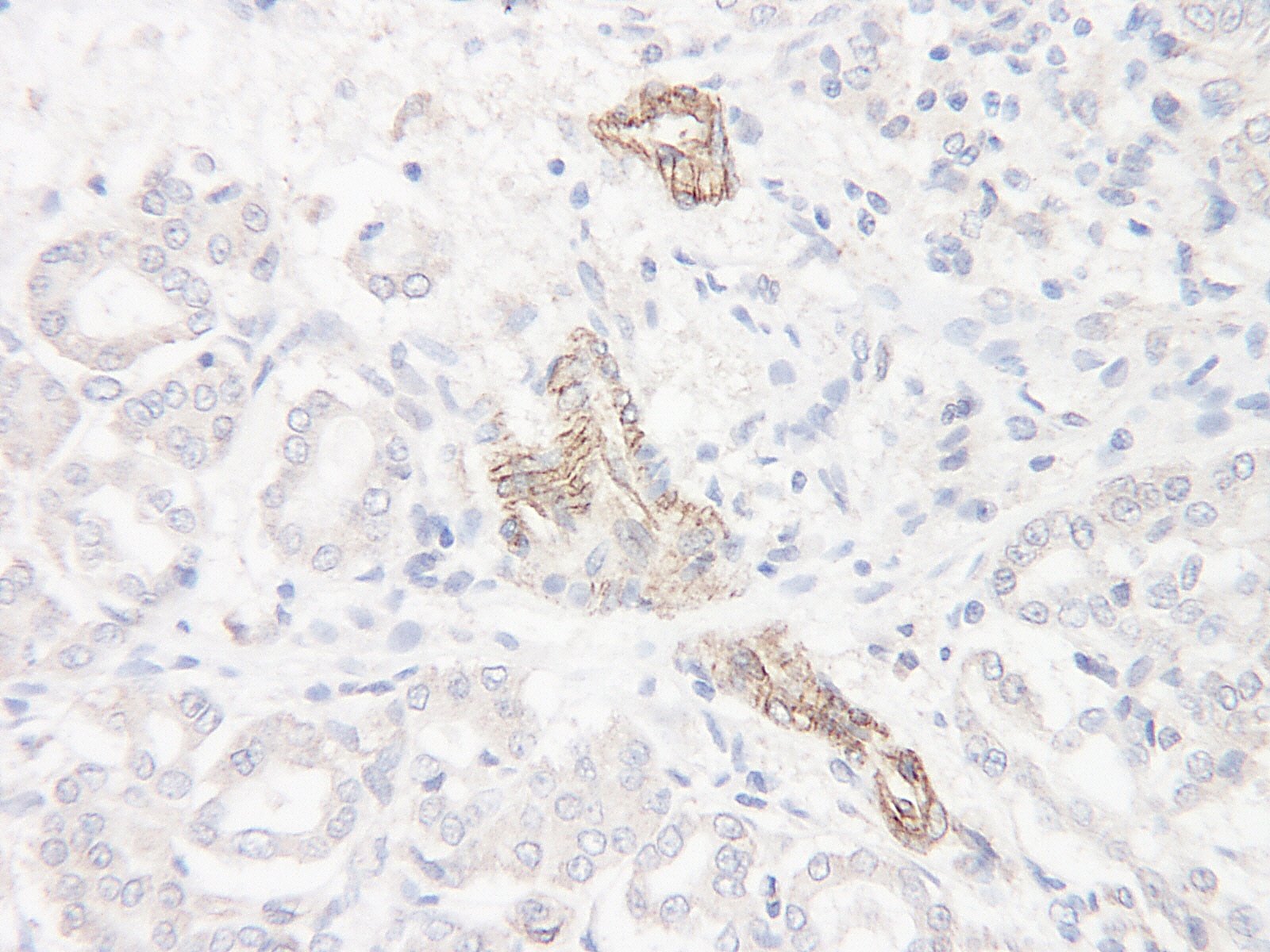 CCL1 Antibody