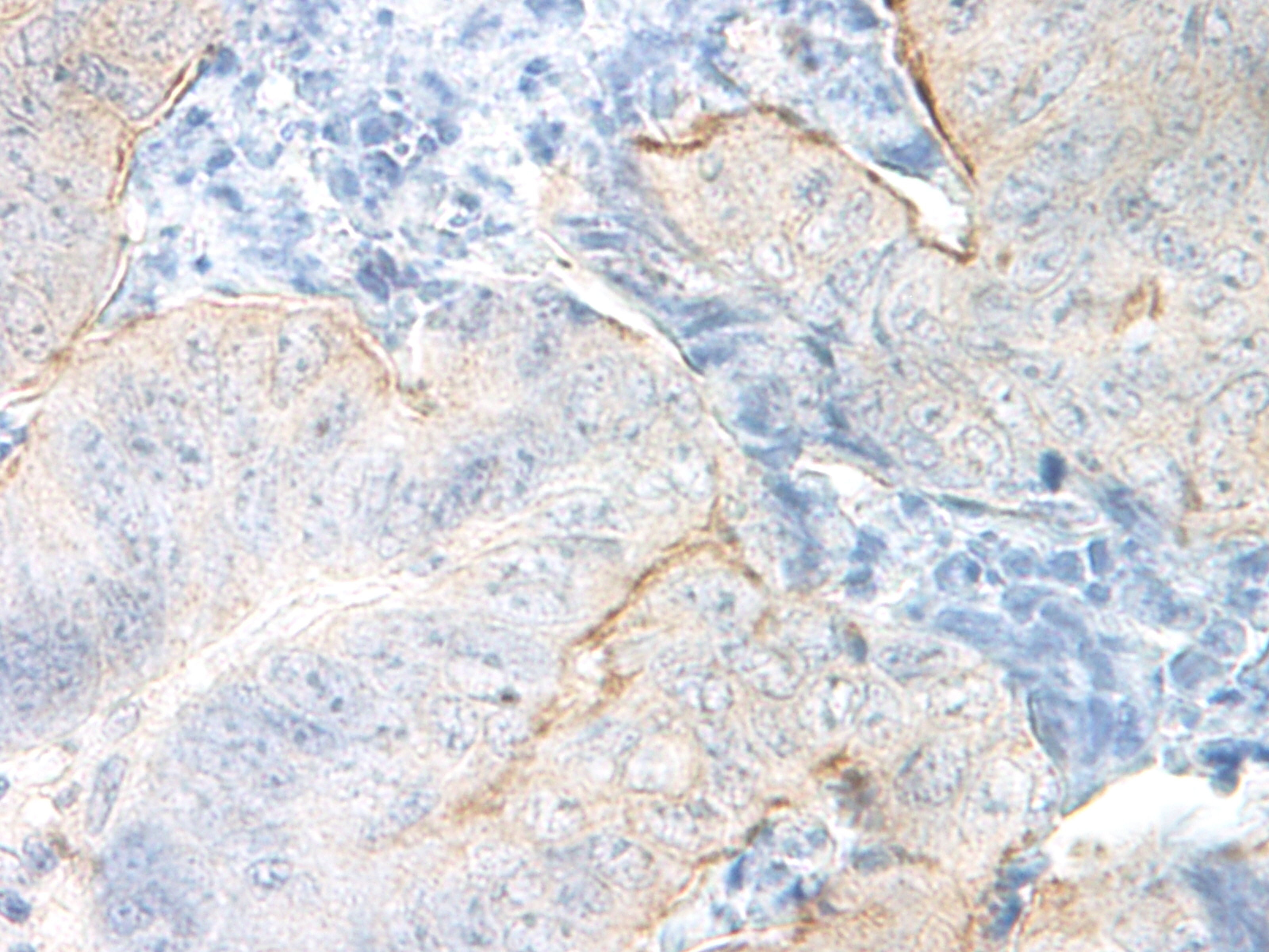 CCL14 Antibody