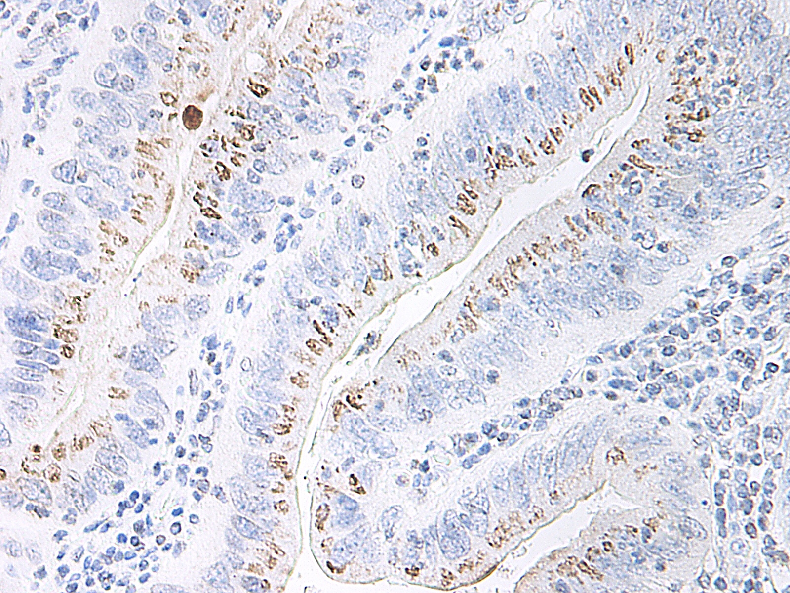 GRO-B Antibody