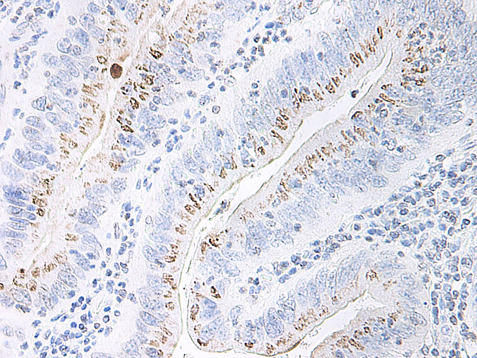 CXCL2 Antibody