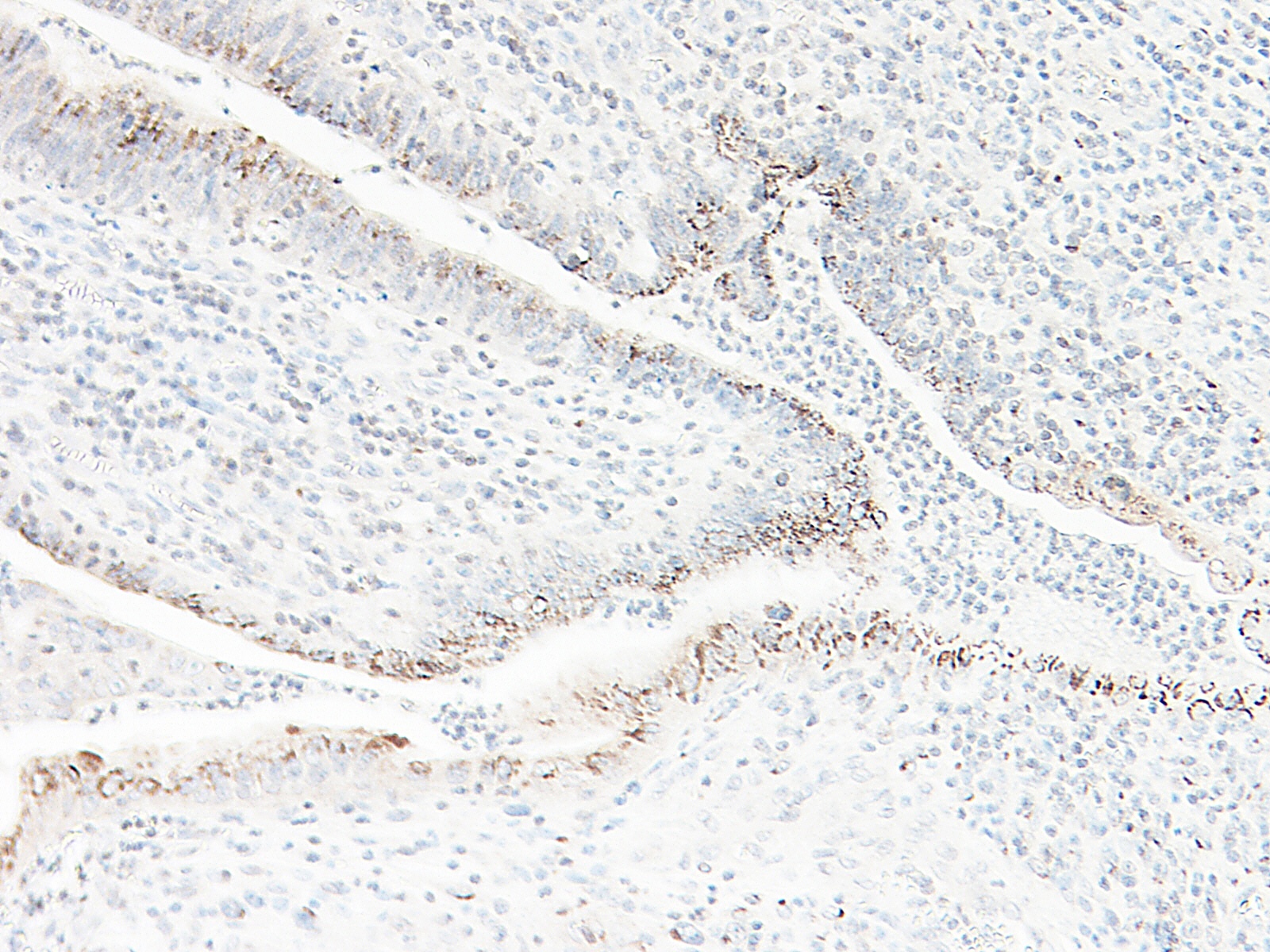 GRO/MGSA Antibody
