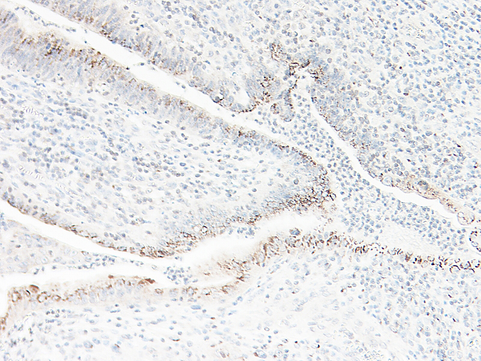 CXCL1 Antibody