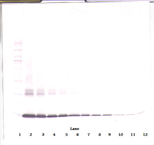 GM-CSF Antibody