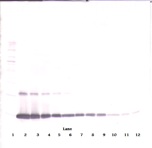 GM-CSF Antibody