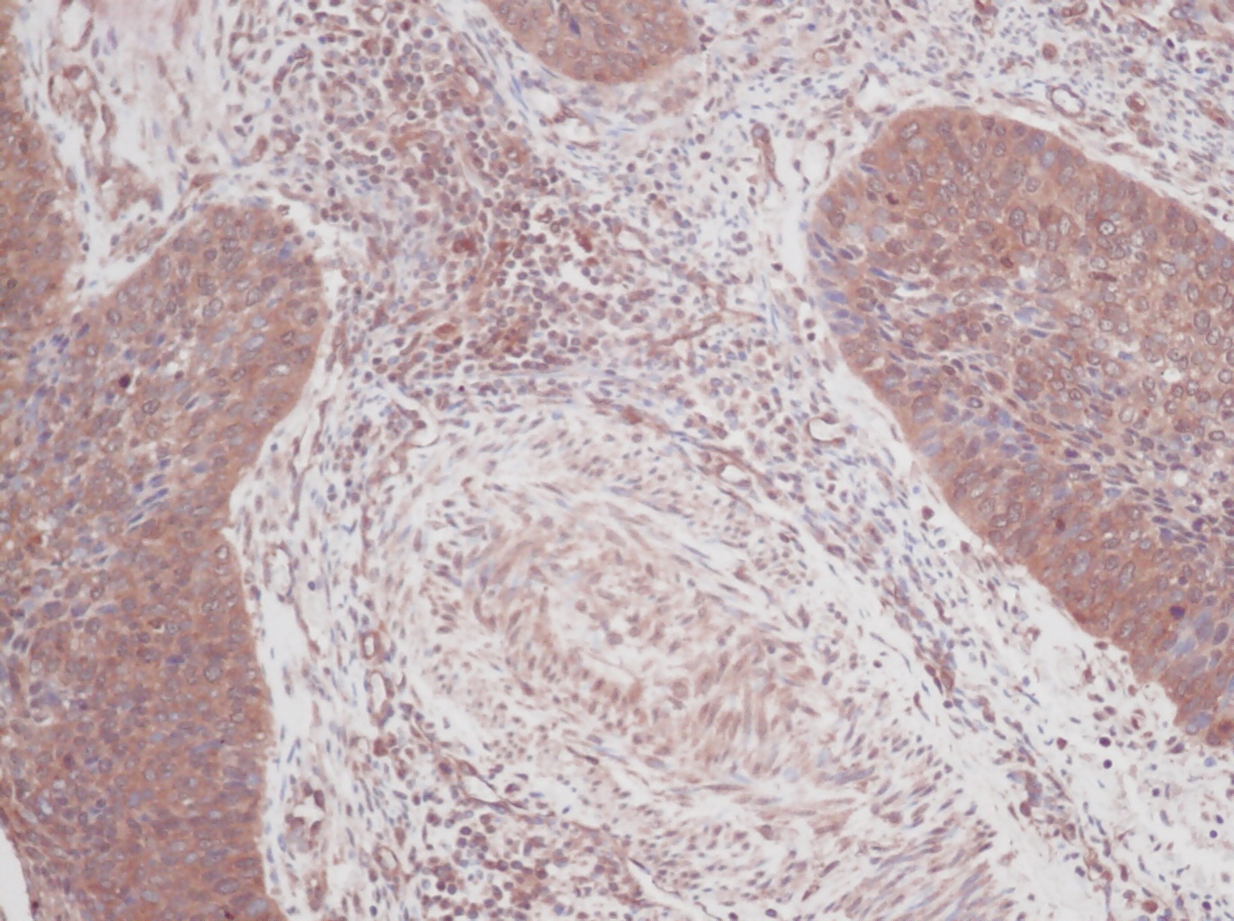 GM-CSF Antibody