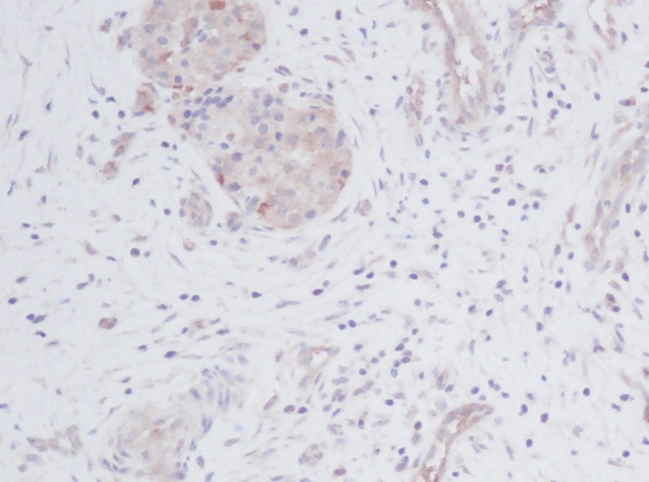CX3CL1 Antibody
