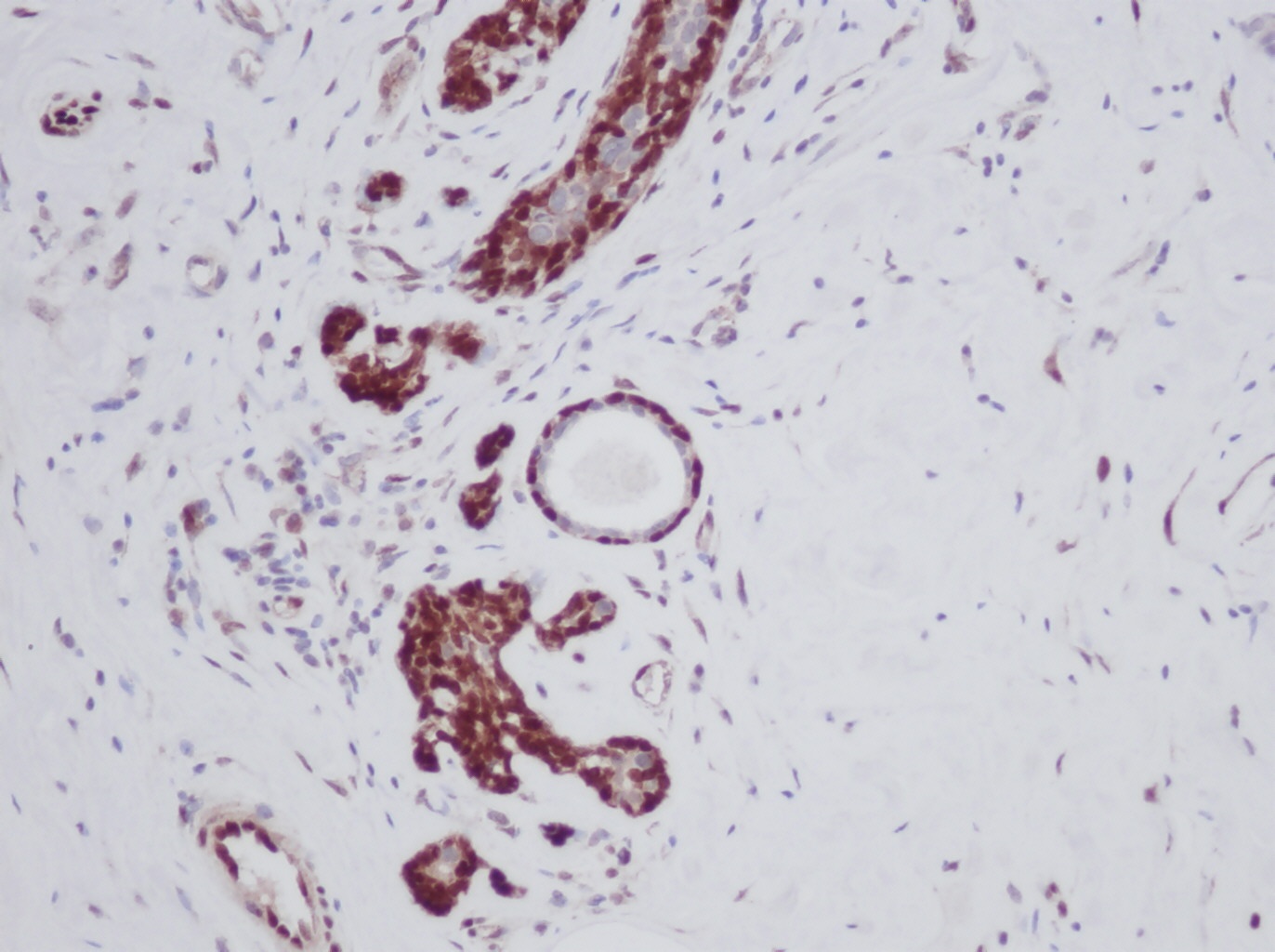 FGF-basic Antibody