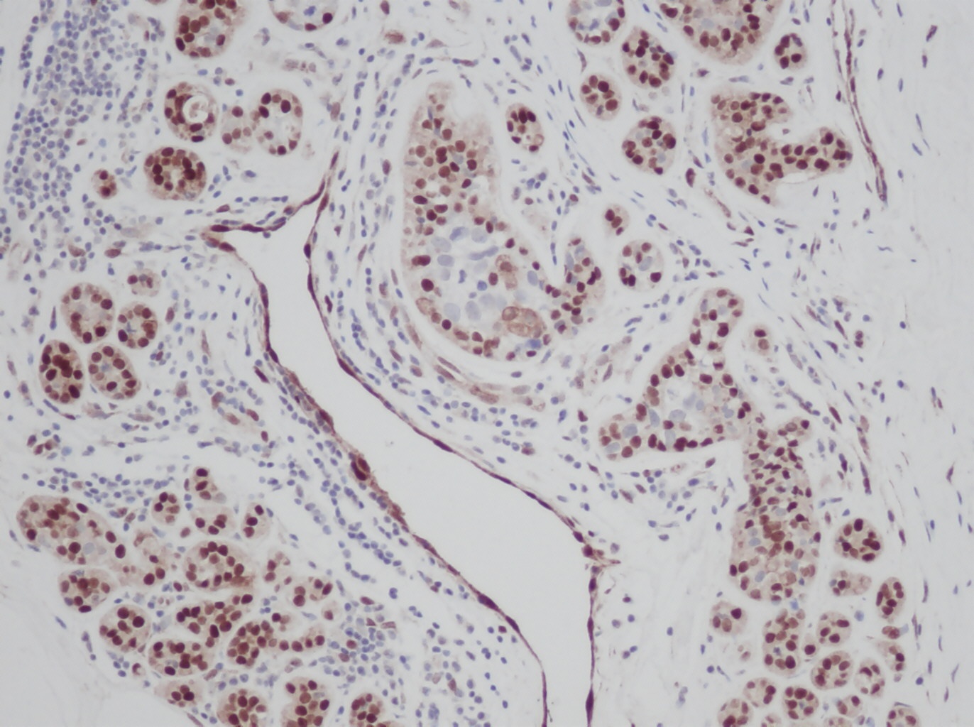 FGF-basic Antibody