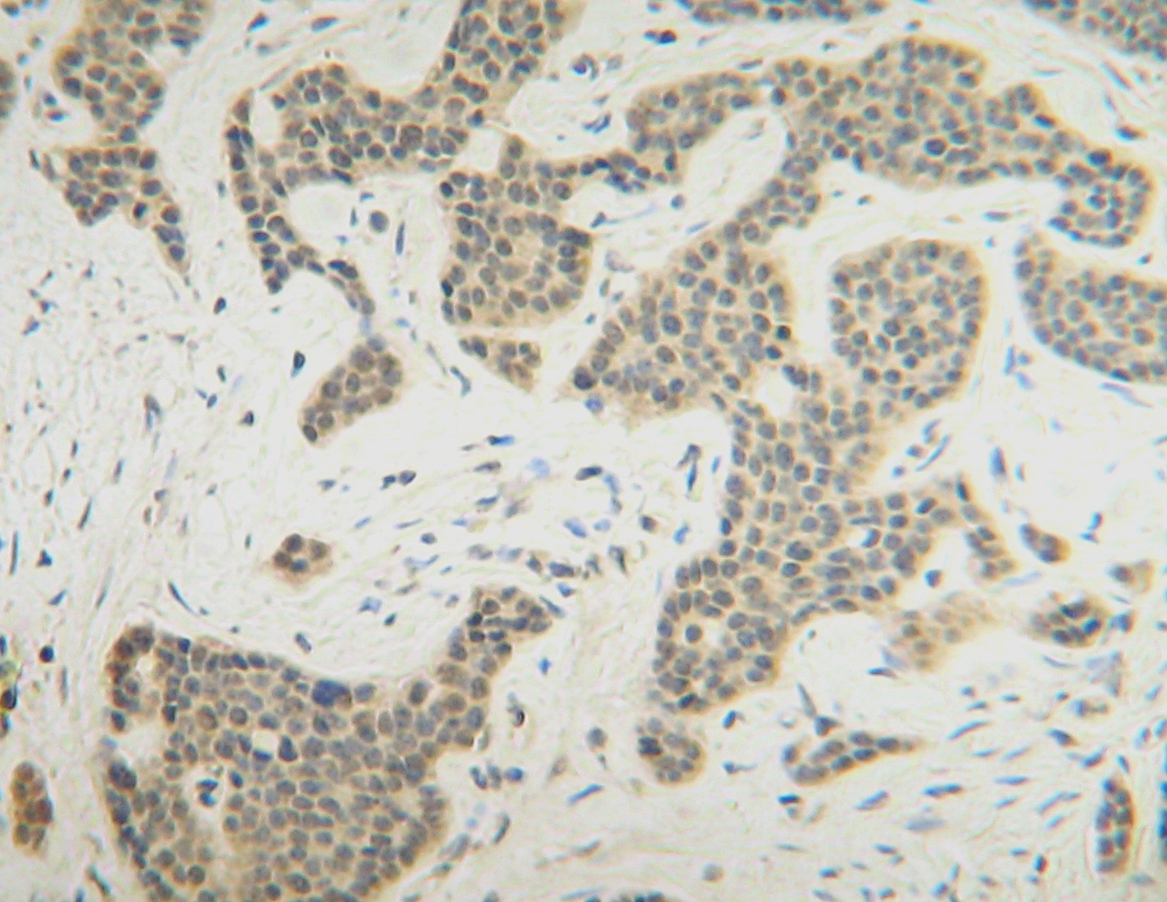 FGF10 Antibody