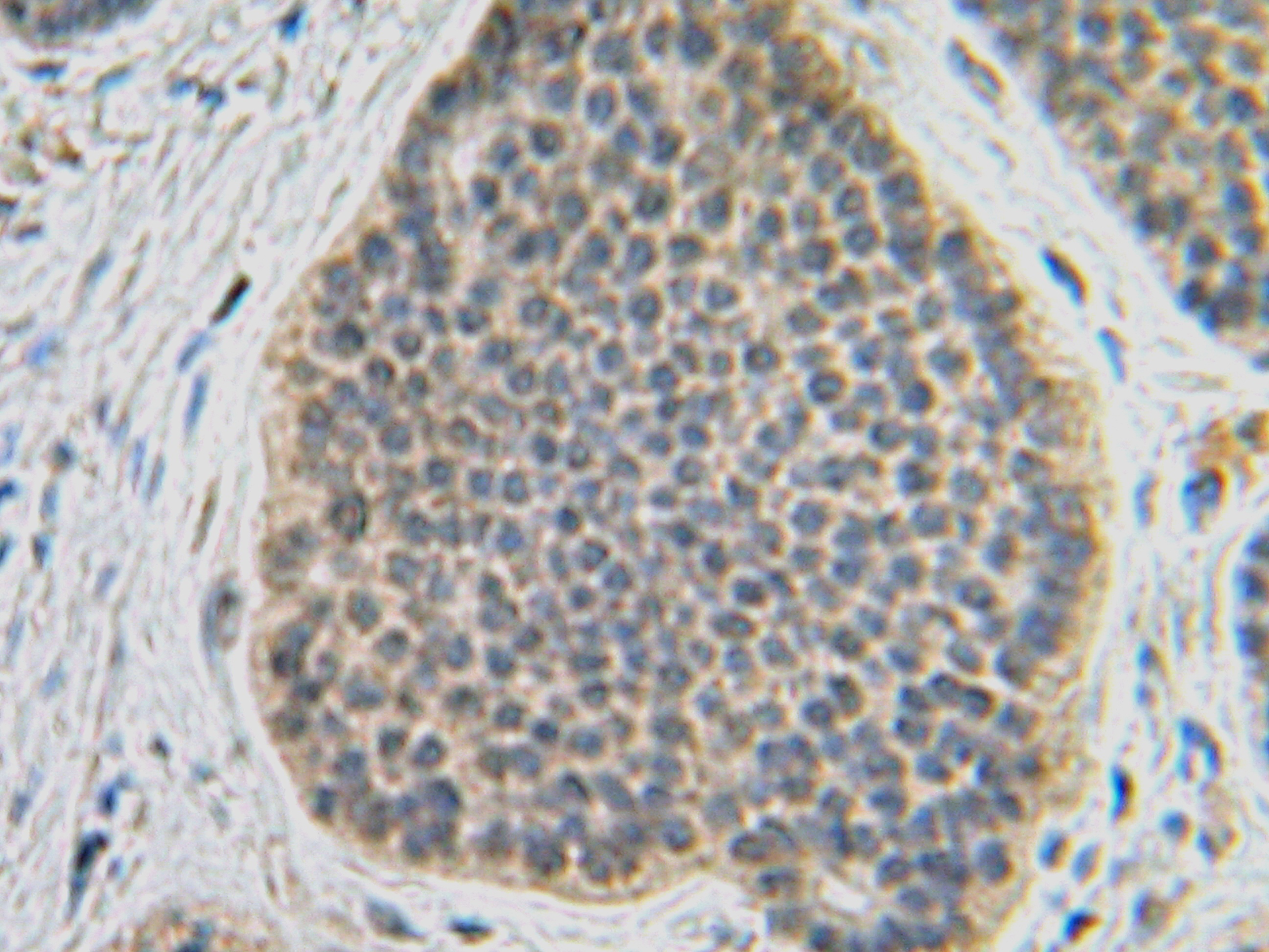 FGF10 Antibody