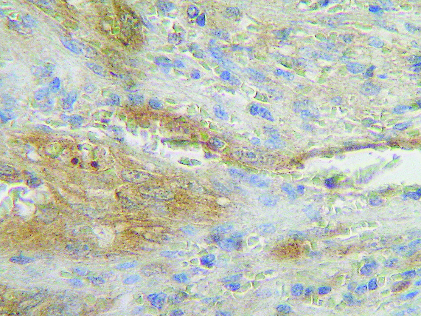 Fas Ligand Antibody