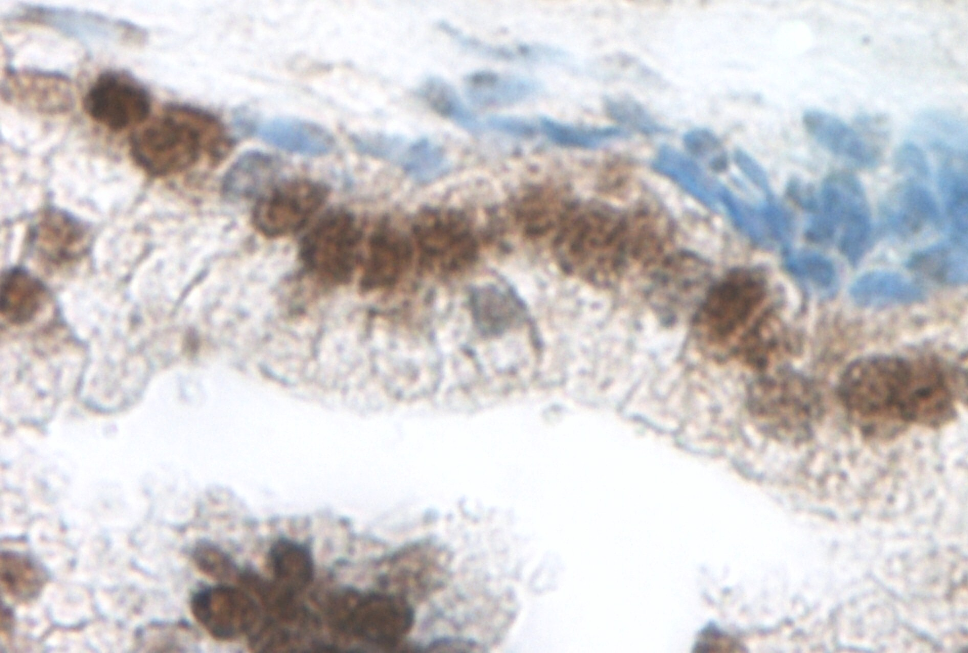 Exodus-2 Antibody