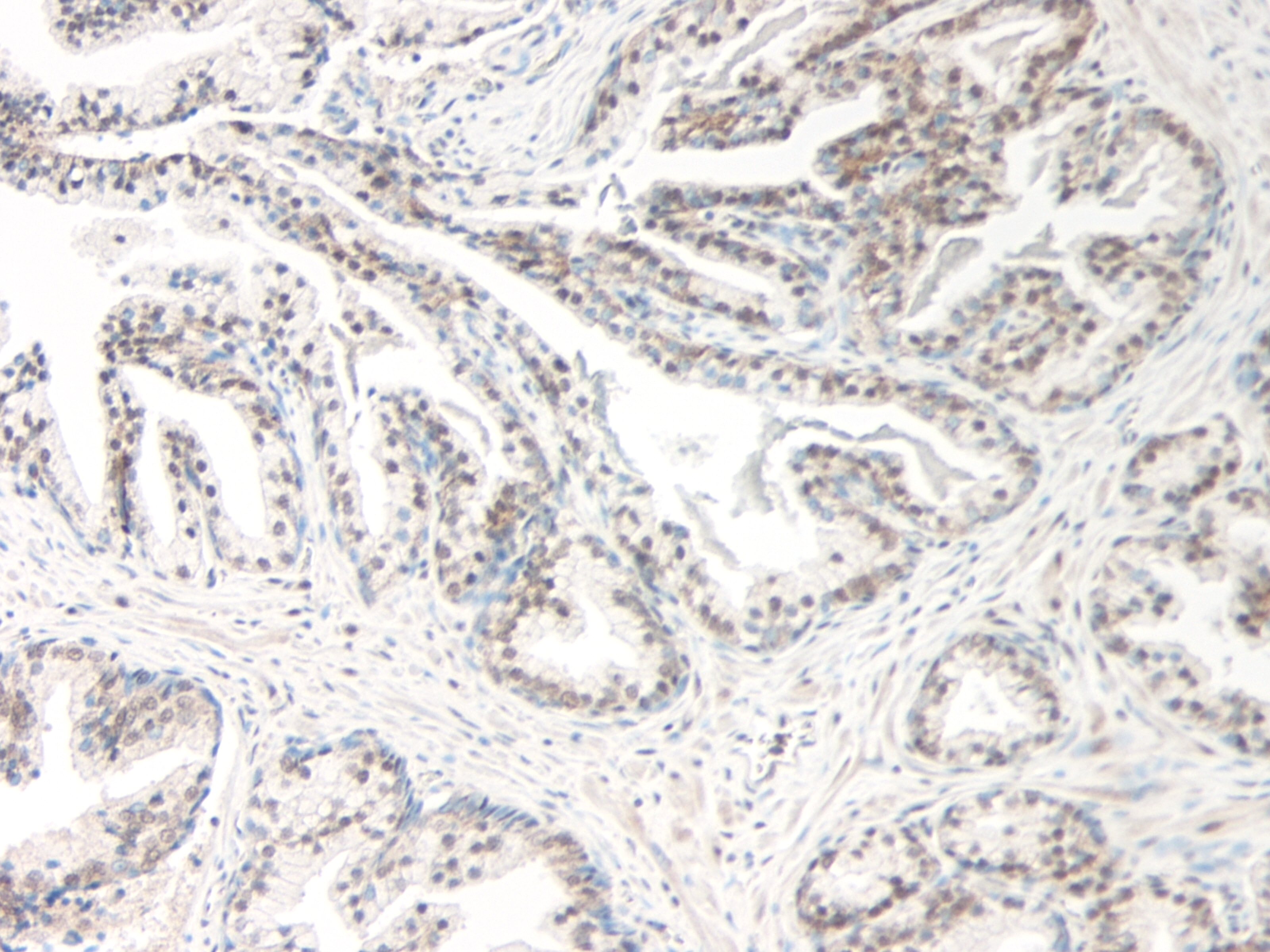 Exodus-2 Antibody