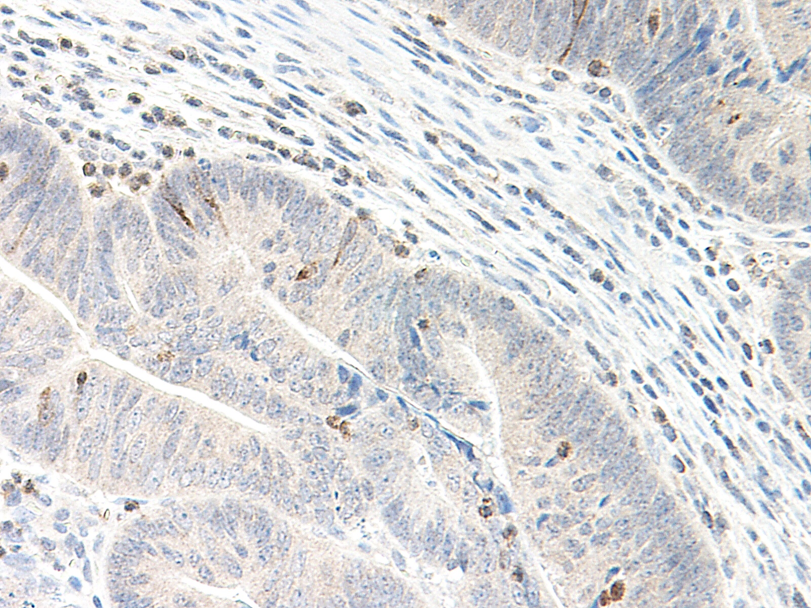 CXCL5 Antibody