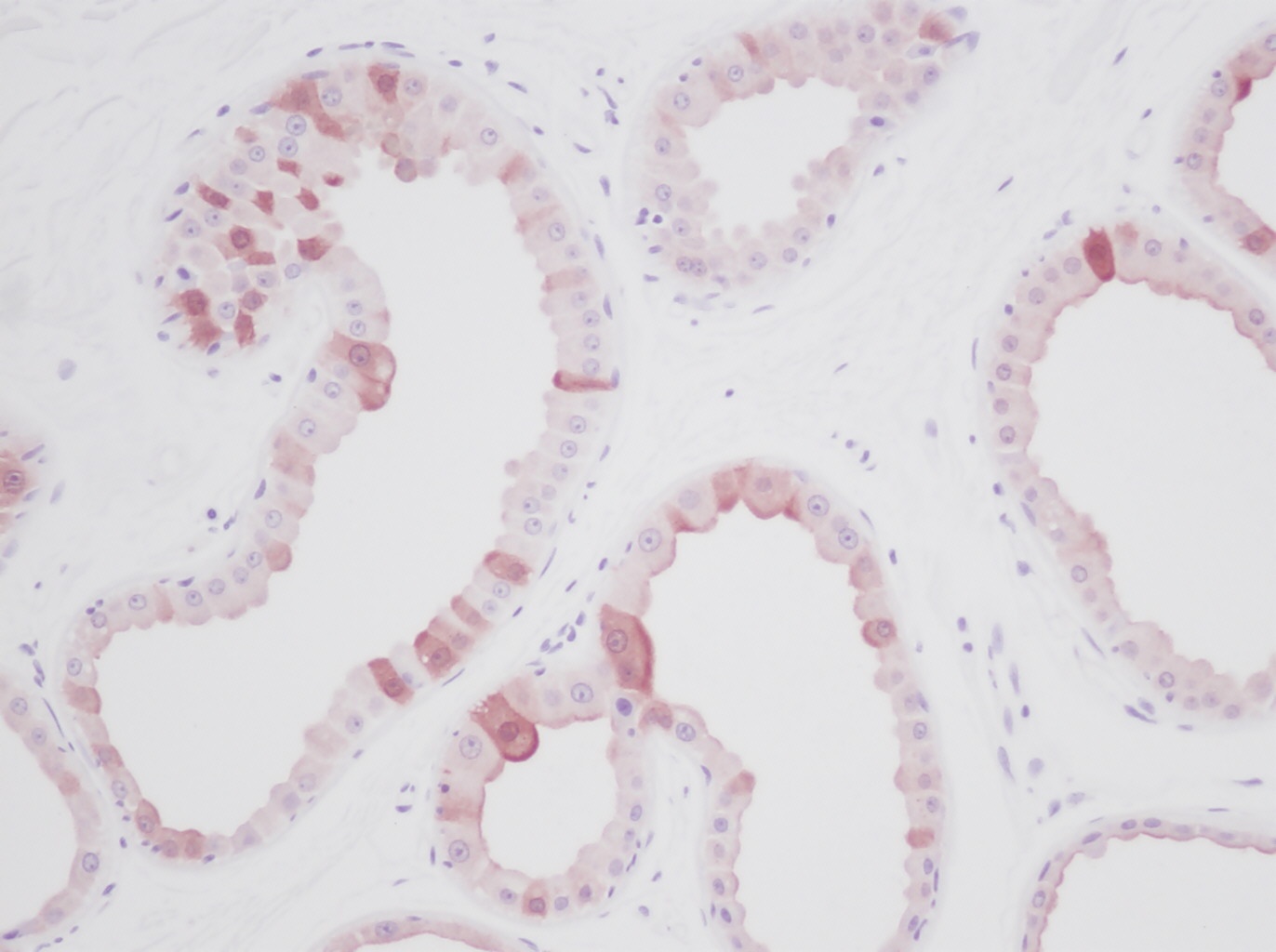 EGF Antibody