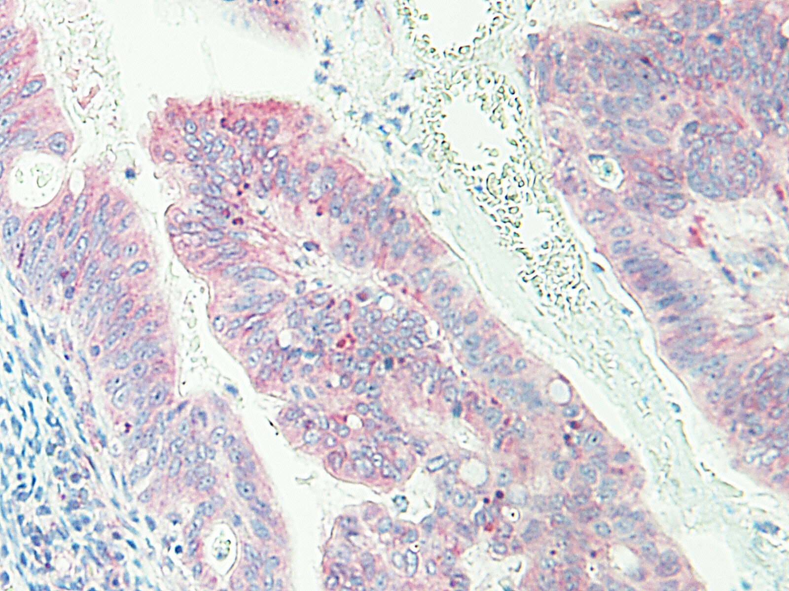 CXCL16 Antibody