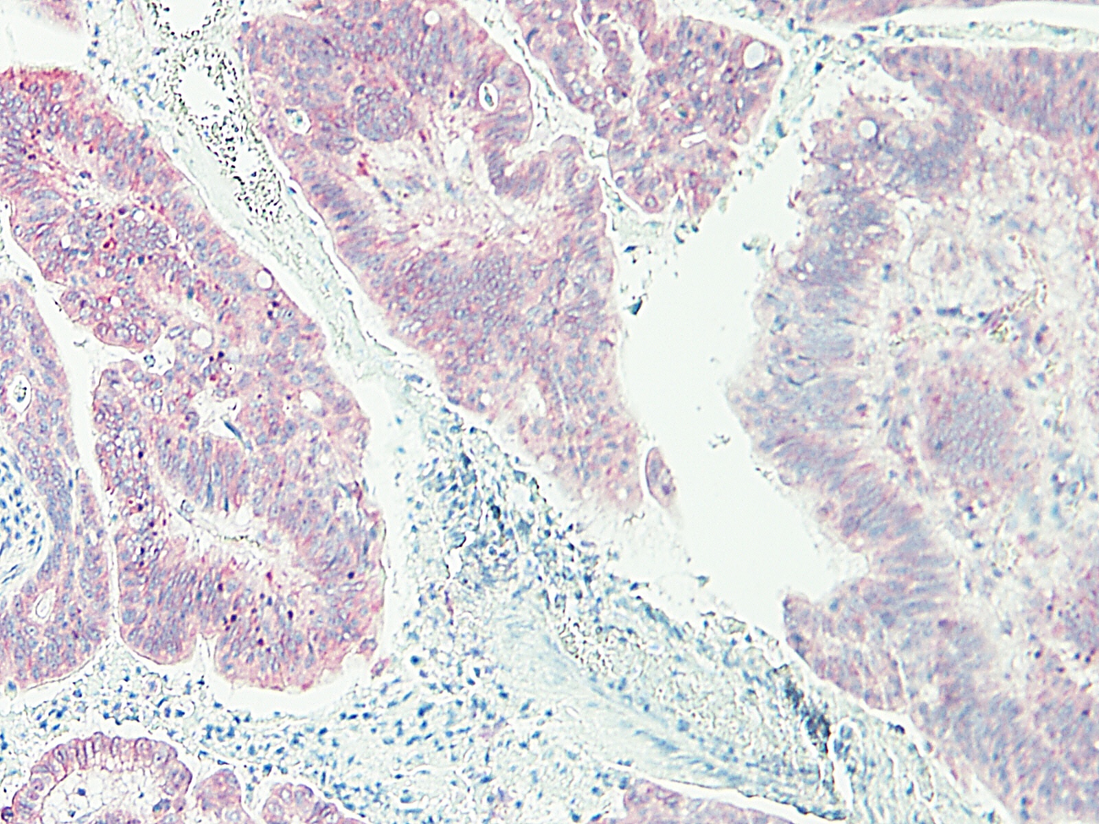 CXCL16 Antibody