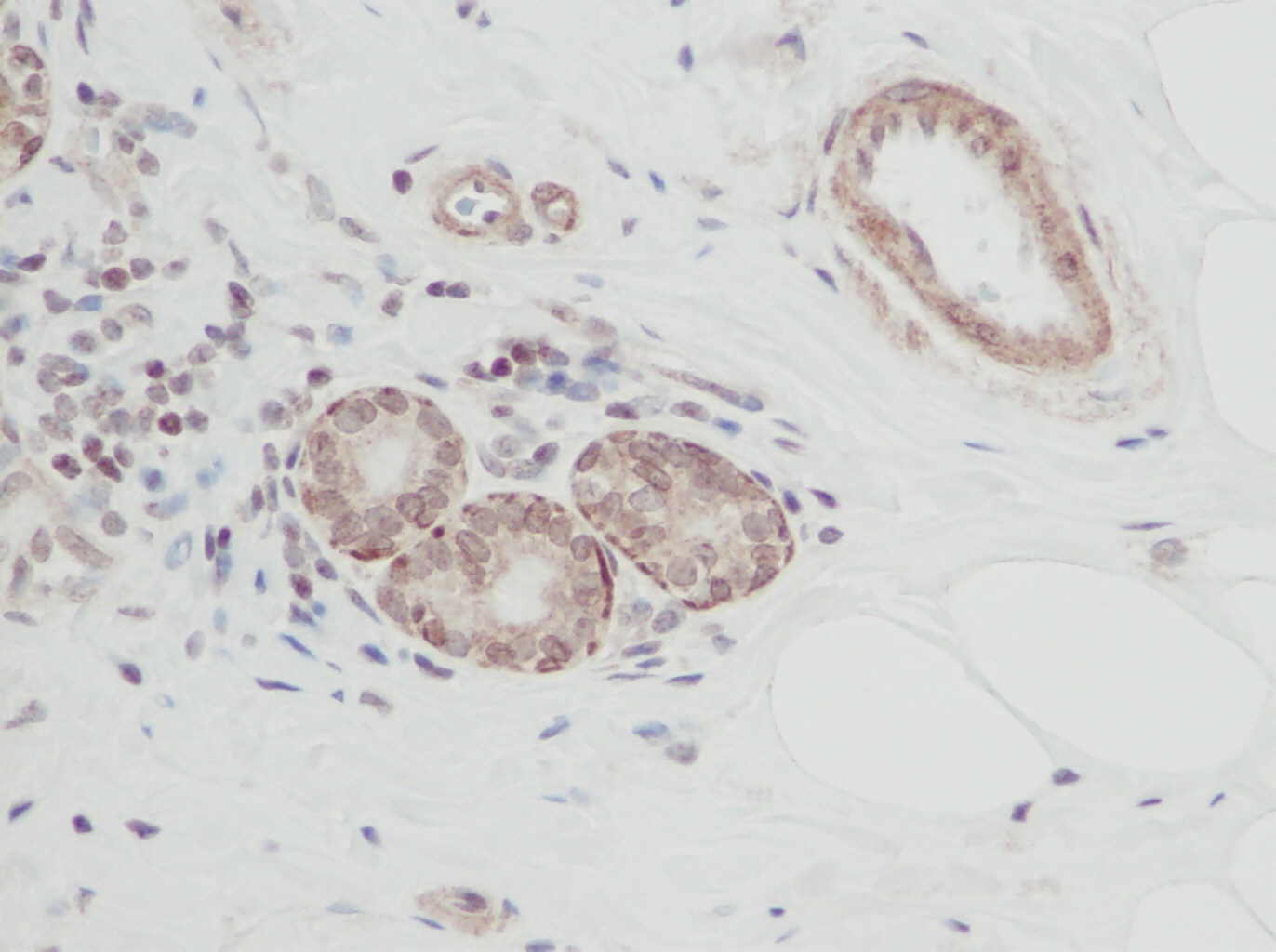 CTF1 Antibody