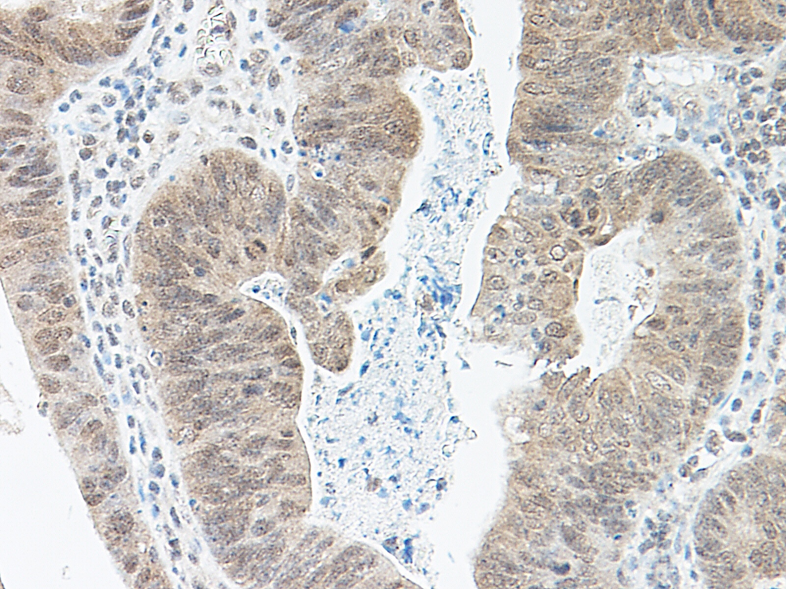 BMP2 Antibody