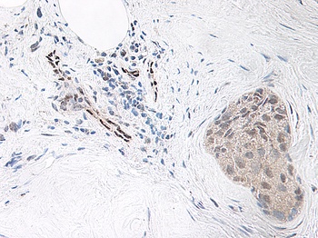 IL-33 Antibody