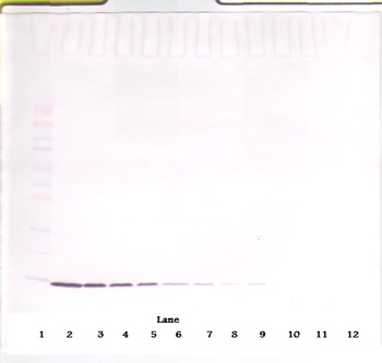 IL-2 Antibody [2G7-25-3]