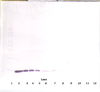 IL-2 Antibody [2G7-25-3]
