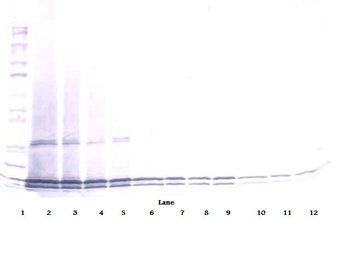 IL17B Antibody