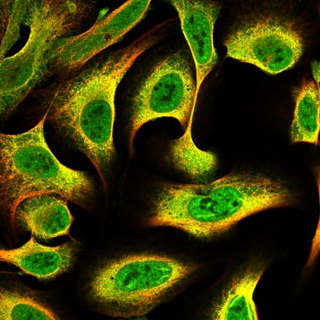 IGF-BP5 Antibody