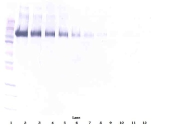 EGFR Antibody (Biotin)
