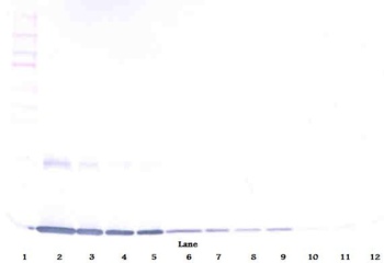GM-CSF Antibody