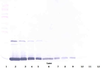GM-CSF Antibody