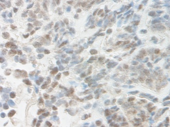 NAMPT Antibody