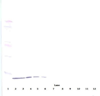 IP-10 Antibody [3.3-1G1-2G7-2F6]