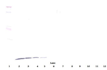 IP-10 Antibody [3.3-1G1-2G7-2F6]