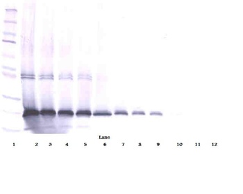 IL17D Antibody